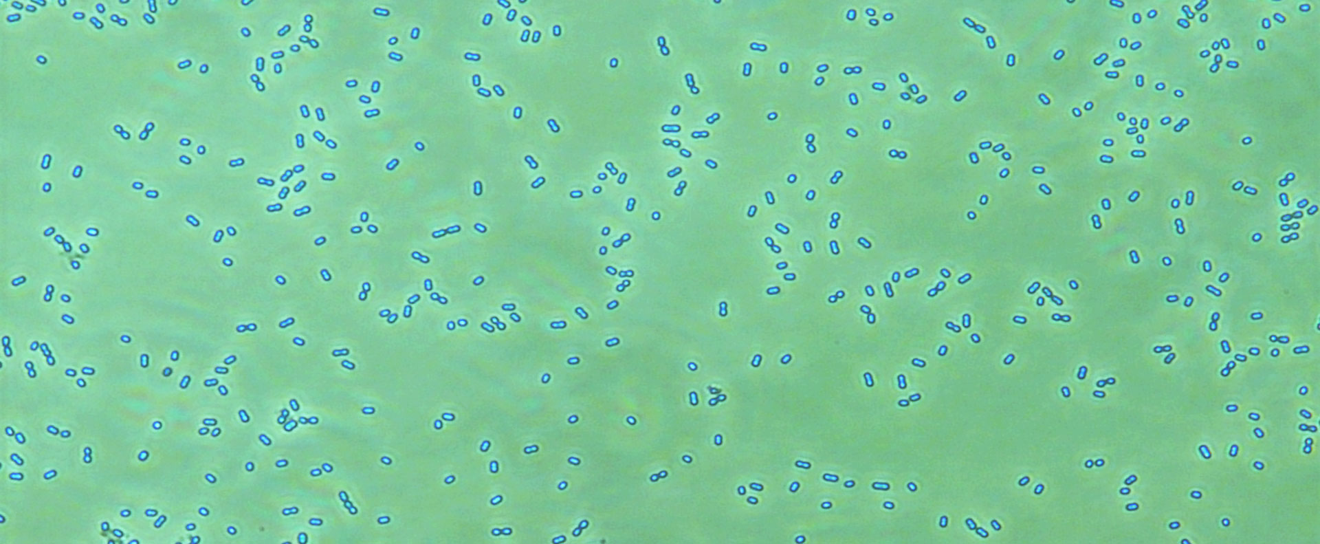 Researchers Identified Structure And Function Of First Deacylase Enzyme Cdda In Cyanobacteria 